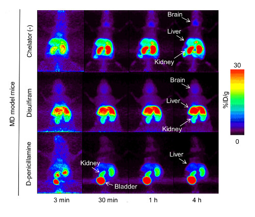 PET images showing that D-penicillamine reduces copper accumulation in the kidney