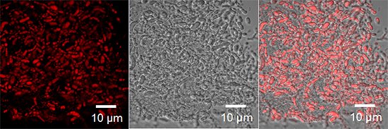 リグニン誘導体を炭素源とし、PHAを蓄積したRalstonia eutrophaの顕微鏡写真の画像