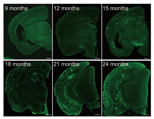fluorescence imaging showing ABeta pathology in model mouse brains