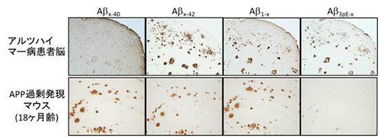 アルツハイマー病患者とAPP過剰発現マウスのアミロイド斑の比較の図