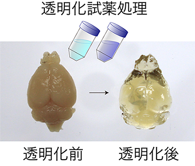 成体マウス全脳の透明化の図