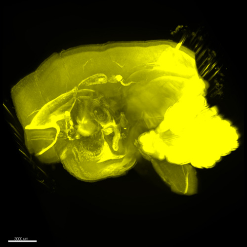 3D reconstruction of brain after clearing with CUBIC