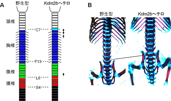 異性型PRC1の遺伝子結合領域を欠損させたマウスの脊椎骨の図