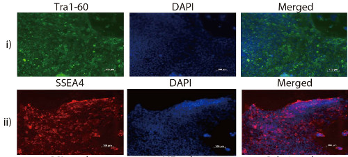 Fluorescence imaging: immunostained human iPSCs