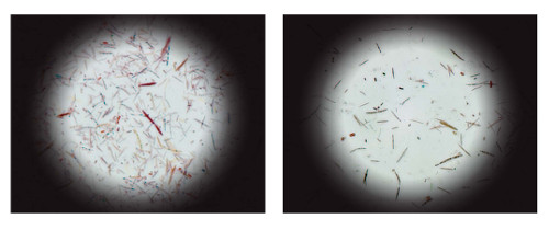 photos of large and small cecal bacteria communities in mice