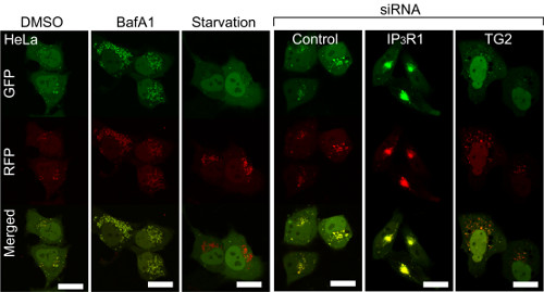 fluorescence imaging: autophagy deficits after IP3R loss