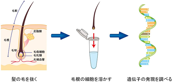 毛根細胞の解析方法の図