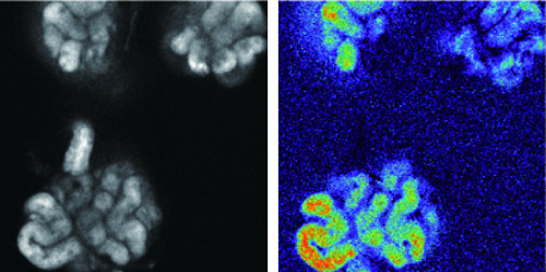 imaging: calcium release in activated sweat glands