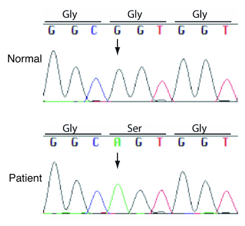 Diagram showing the mutation and the altered structure in IP3R2