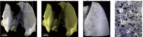 visualization of lung epithelial cells