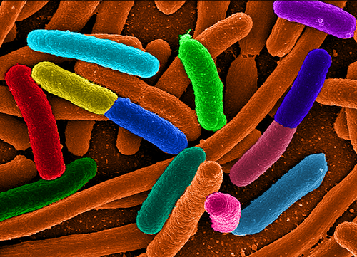 photo of E. coli via election microscope