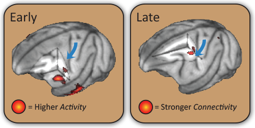 Schematic showing brain regions involved in motor-function recovery