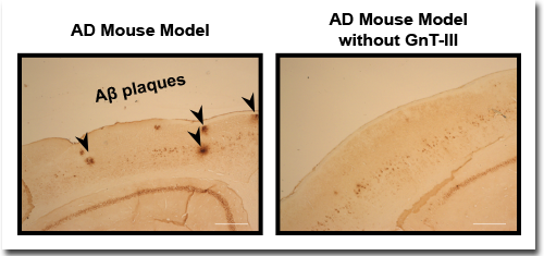 Immunostaining of Aβ plaques 