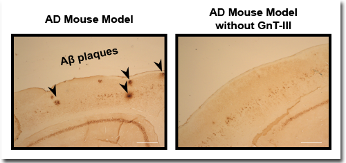 Immunostaining of Aβ plaques