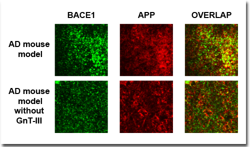 Immunostaining of mouse brain showing locatization of BACE1 and APP