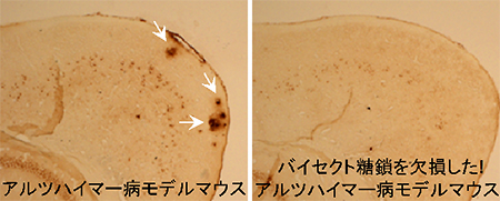 マウス脳におけるアミロイドβの染色像の図