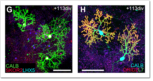 Images of mature Purkinje cells grown from human embryonic stem cells