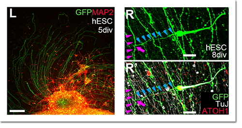 Pictures showing migrating granule cells derived from human ES cells