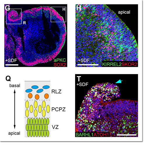 Images showing neuroepithelium and laminar structure