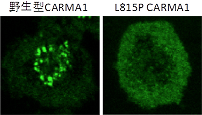 野生型および815P CARMA1の凝集体形成の観察結果の図