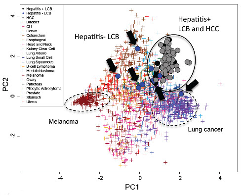 Figure showing clustering of cases in liver-related cancers