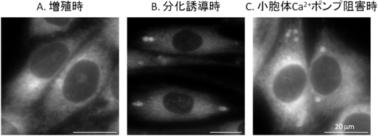 筋芽細胞における小胞体膜構造の変化の図