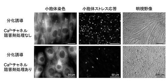 筋分化における小胞体内カルシウム枯渇の重要性の図