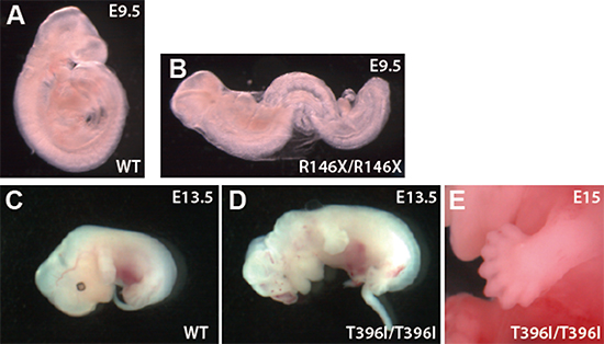 野生型マウス、R146X変異マウス、T396I変異マウスの胚の図
