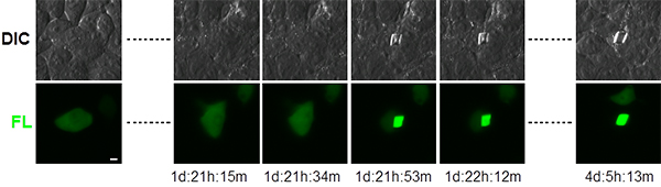 Xpaタンパク質を発現するHEK293細胞のタイムラプスイメージングの図