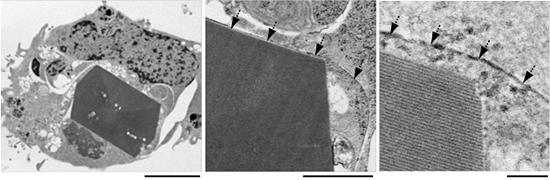 細胞質内にXpa結晶を抱えるHEK293細胞の透過型電子顕微鏡画像の図