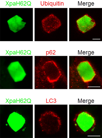 Xpa改変体の結晶がユビキチン、p62、LC3で標識されている様子の図