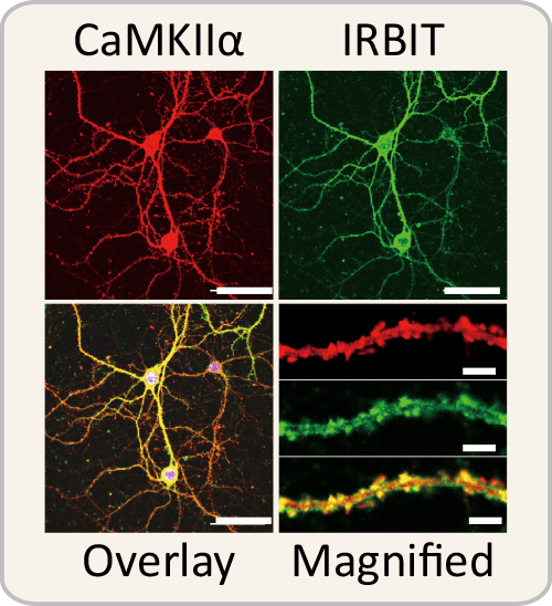 Image showing co-localization of IRBIT with CaMKIIα