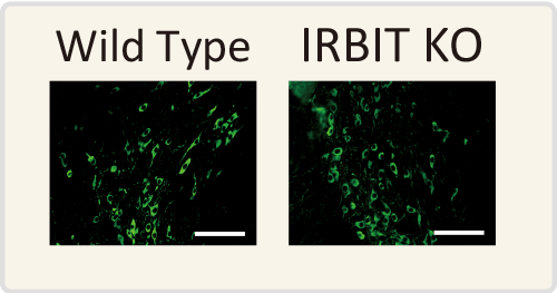 Images showing levels of phosphorylated tyrosine hydroxylase