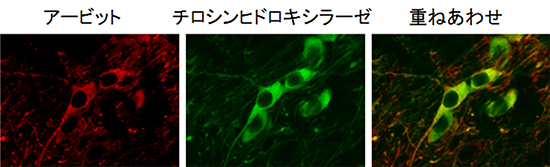 腹側被蓋野(VTA)のドーパミン作動性神経細胞におけるアービットの発現の図