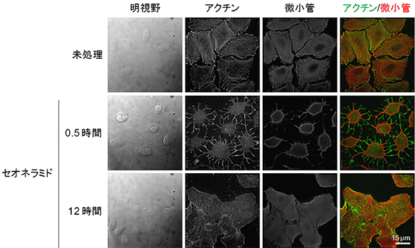 セオネラミドによる細胞の一過的な収縮の図