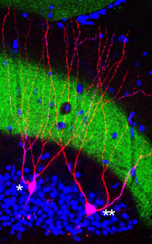 An engram cell (left)