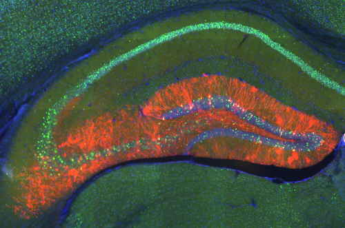 Cross-section showing a positive memory