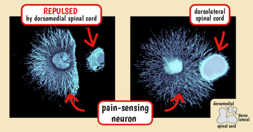 Images showing nociceptive neurons being repelled by dorsomedial spinal cord