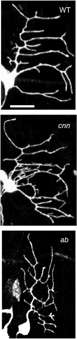 Images showing how centrosomin limits dendritic branching