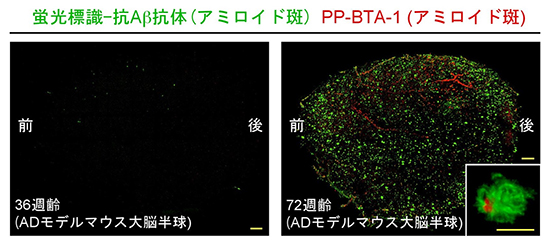 アルツハイマー病モデルマウスの脳で観察されるアミロイド斑の図