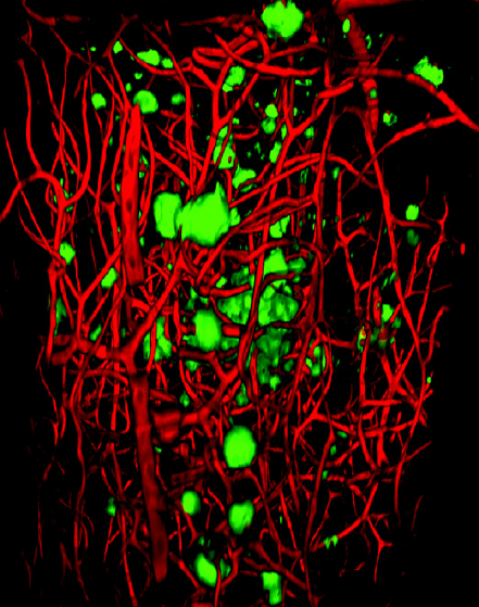 Visualizing Aβ plaques