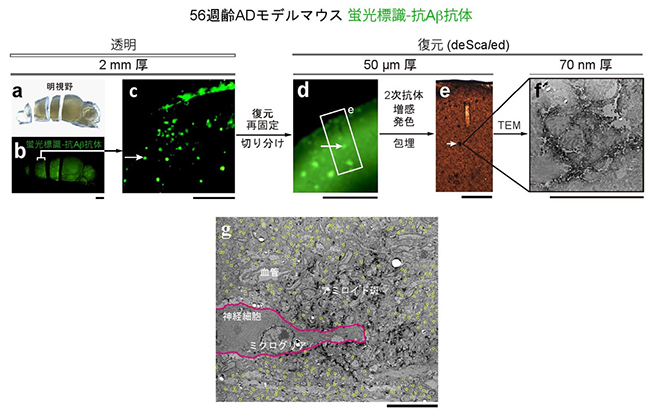 1つのアミロイド斑をさまざまな空間解像度で観察した図