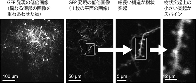 マーモセット大脳皮質のスパイン画像の図