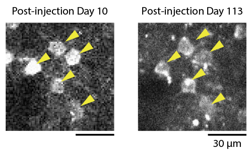 Images of the same neurons after over 100 days.