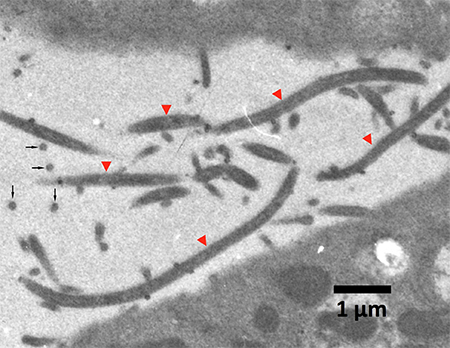 Vero E6細胞と共培養したフィロバクテリウム・ローデンティウムの透過電子顕微鏡写真の図