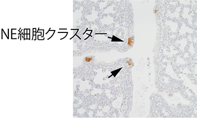 マウス胎児のNE細胞を染色した画像の図