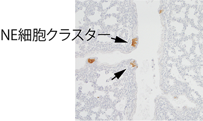 肺の細胞が自ら歩いて集まる様子を撮影