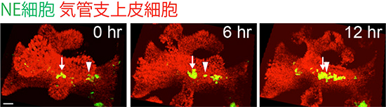 自ら歩いて気管支分岐点へ移動するNE細胞の画像