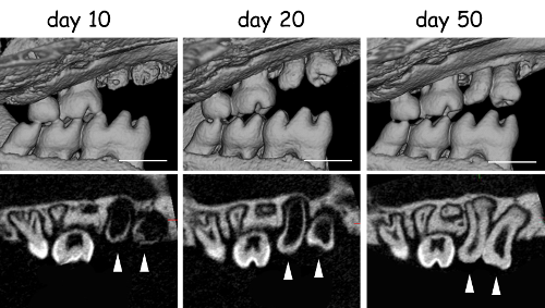 Transplanted teeth