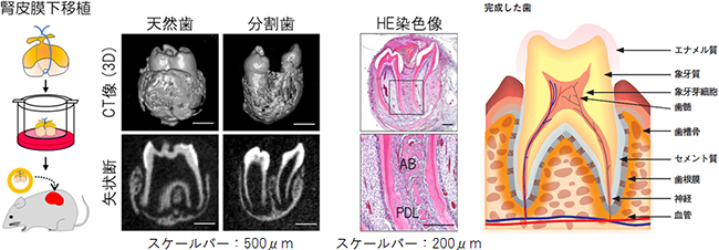 腎皮膜下に移植し発生した分割歯の解析図